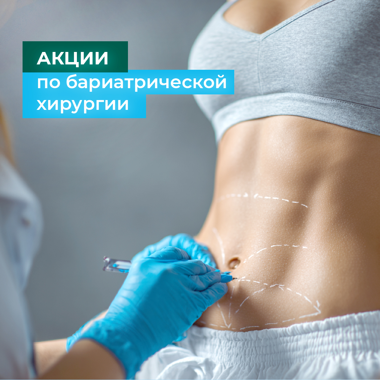 Бариатрическая операция  + устранение ГПОД В ПОДАРОК!