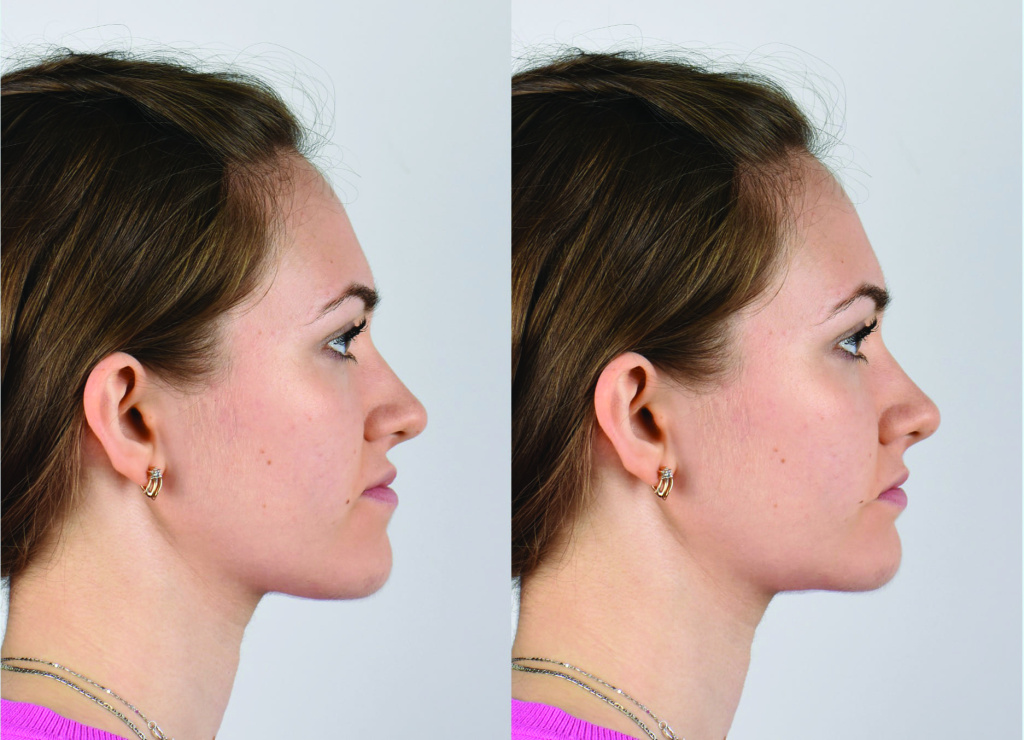 1левую-взять_L-_1_ (1).jpg