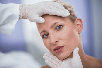 Подтяжка лица (face lifting): обзор хирургических методов
