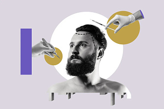 Пересадка волос: ответы на главные вопросы